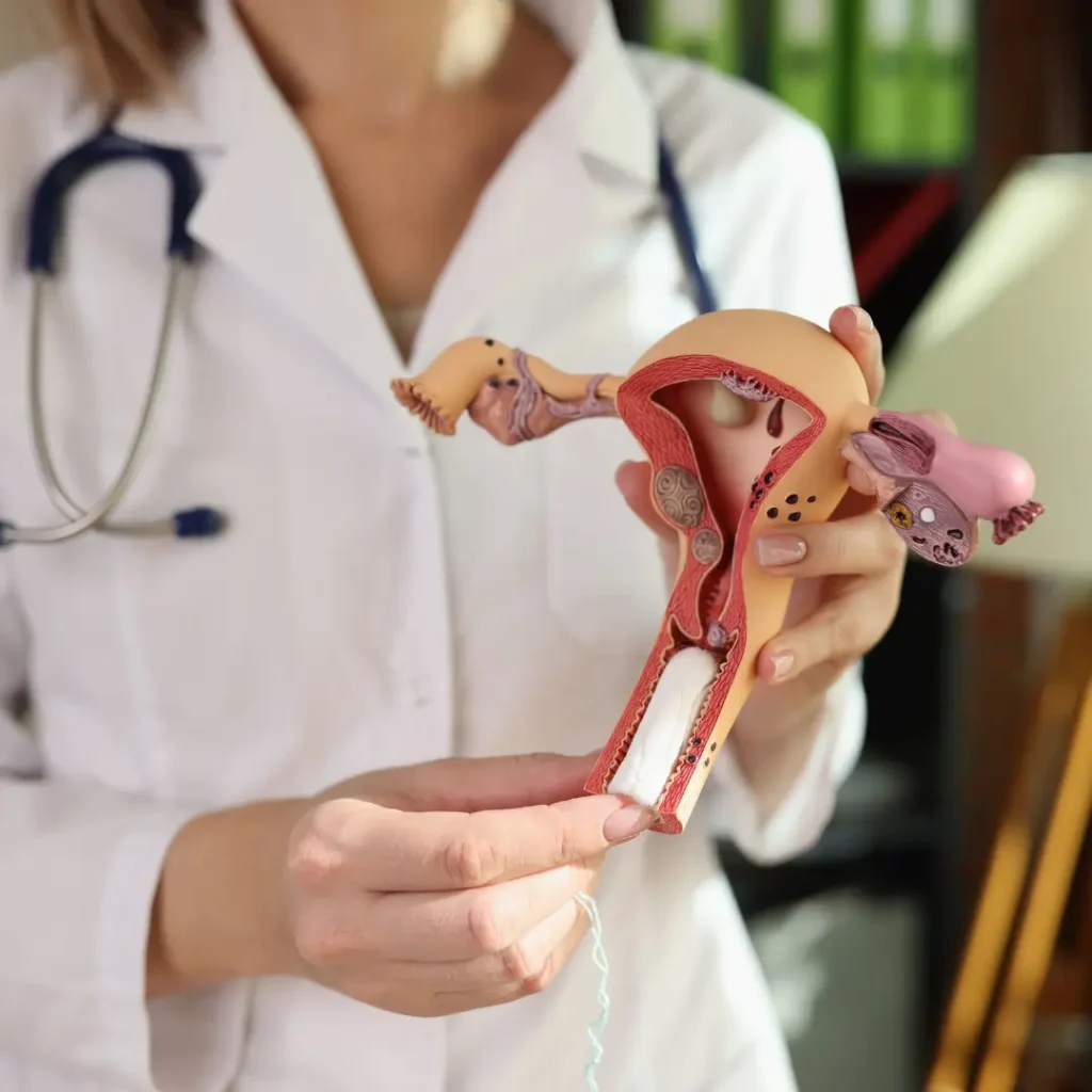 Rare Gynaecological Cancers Appeal